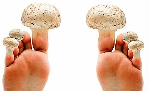 Pilz op den Nägel