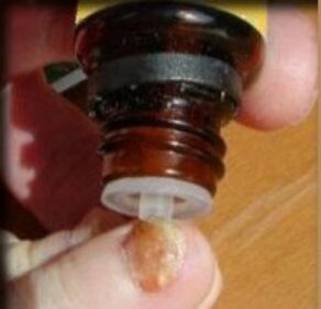 Drëpsen op e Pilz-betraffene Zehenneg opdroen