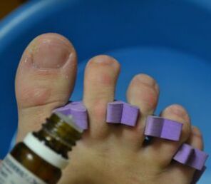 Virbereedung fir d'Behandlung vun Nägel mat Anti-Pilz Drëpsen